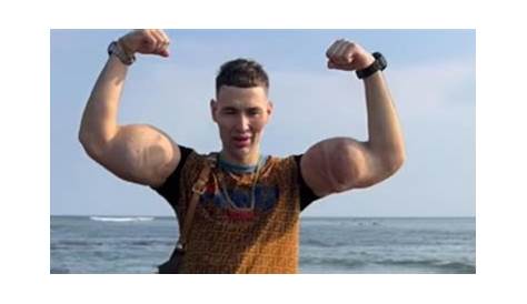 Человек за феноменом «Попай»