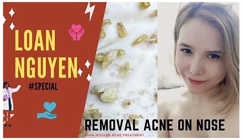 Loan Nguyen Blackhead Videos специально удаляют на Nose Youtube