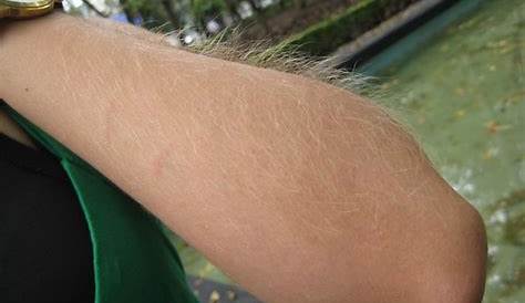 Hairy Arms Flickr Indexwral Новости Дарем