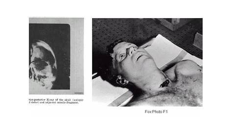 Вскрытие Jfk Junior 1968 The Washington Post