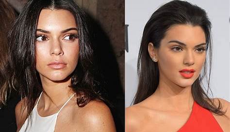 Пластическая хирургия Kendall Jennercareer Подробнее Jenner Nose Job Boob Job Lip Инъекция