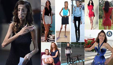 Оригинальное название: The Skinniest Person Ever