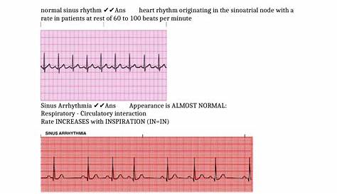 Relias Dysrhythmia Advanced A Quizlet Bsic Test Nswers Bsic