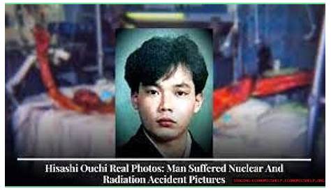 Взгляд изнутри на больничный опыт Хисаши Учи: раскрытие реальных фотографий