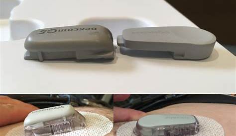 Dexcom G6 Needle Size приблизительный угол и длина подкожной порции