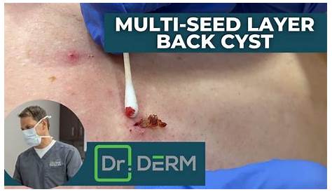 Поддержка Cyst Video и помощь в создании Youtube