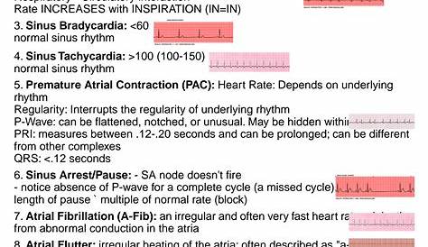 Relias Kaiserbadges Dysrhythmia Basic Test Answers 2023 Дисритмия Basic A A+