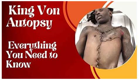 Оригинальное название: King Von Autopsy: The Comprehensive Analysis