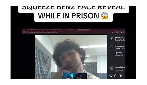 Squeeze Benz Face: все, что вам нужно знать об этом популярном тренде ухода за кожей