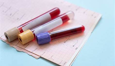 Оригинальное название: Meriter Blood Draw in Madison