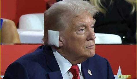 Дональд Трамп: Повязка на неправильном ухе — анализ спора