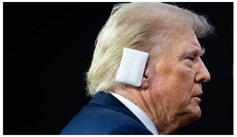 Дональд Трамп сказал, что ухо вернулось?