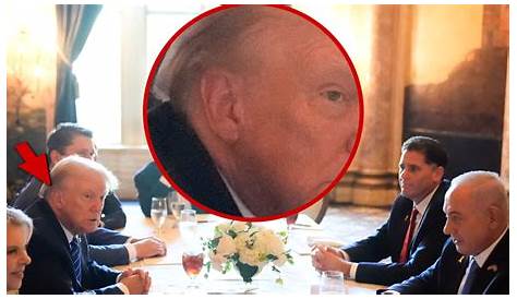 Дональд Трамп без повязки: взгляд на здоровье и имидж