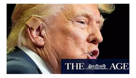 Понять рану Дональда Трампа: причины, последствия и последствия
